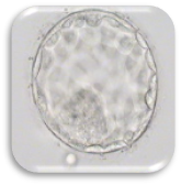 ตัวอ่อนที่ปฏิสนธิ (Zygote : Day 1)